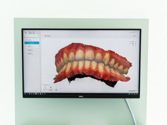 Bezdrátový intraorální scanner 3shape Trios